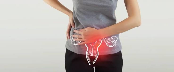 PCOS / PCOD