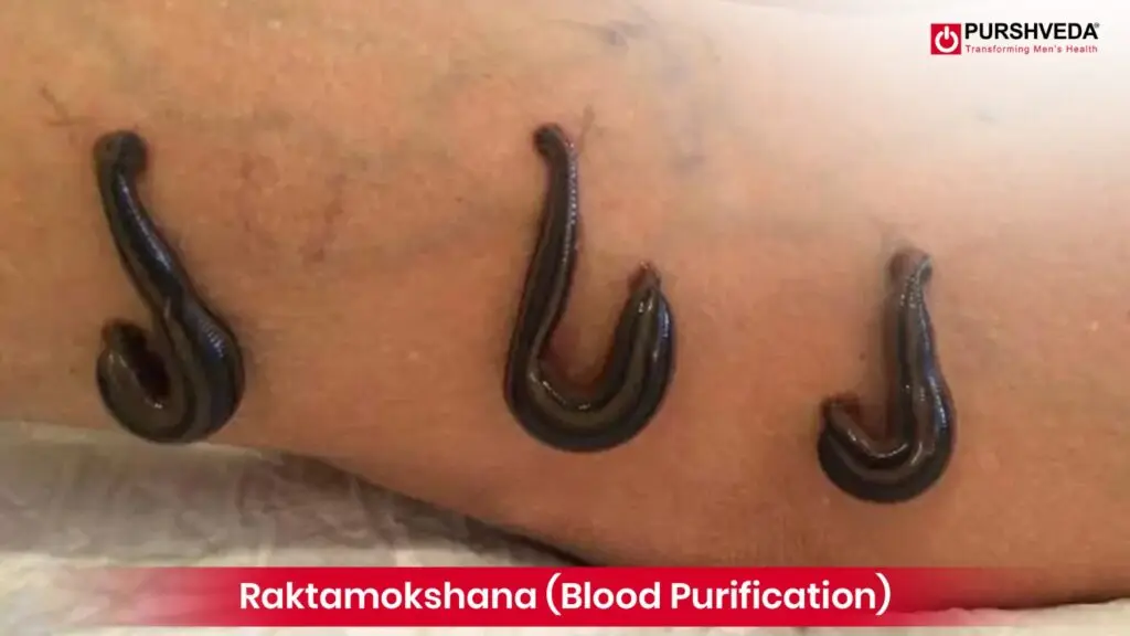 Raktamokshana (Blood Detoxification)
